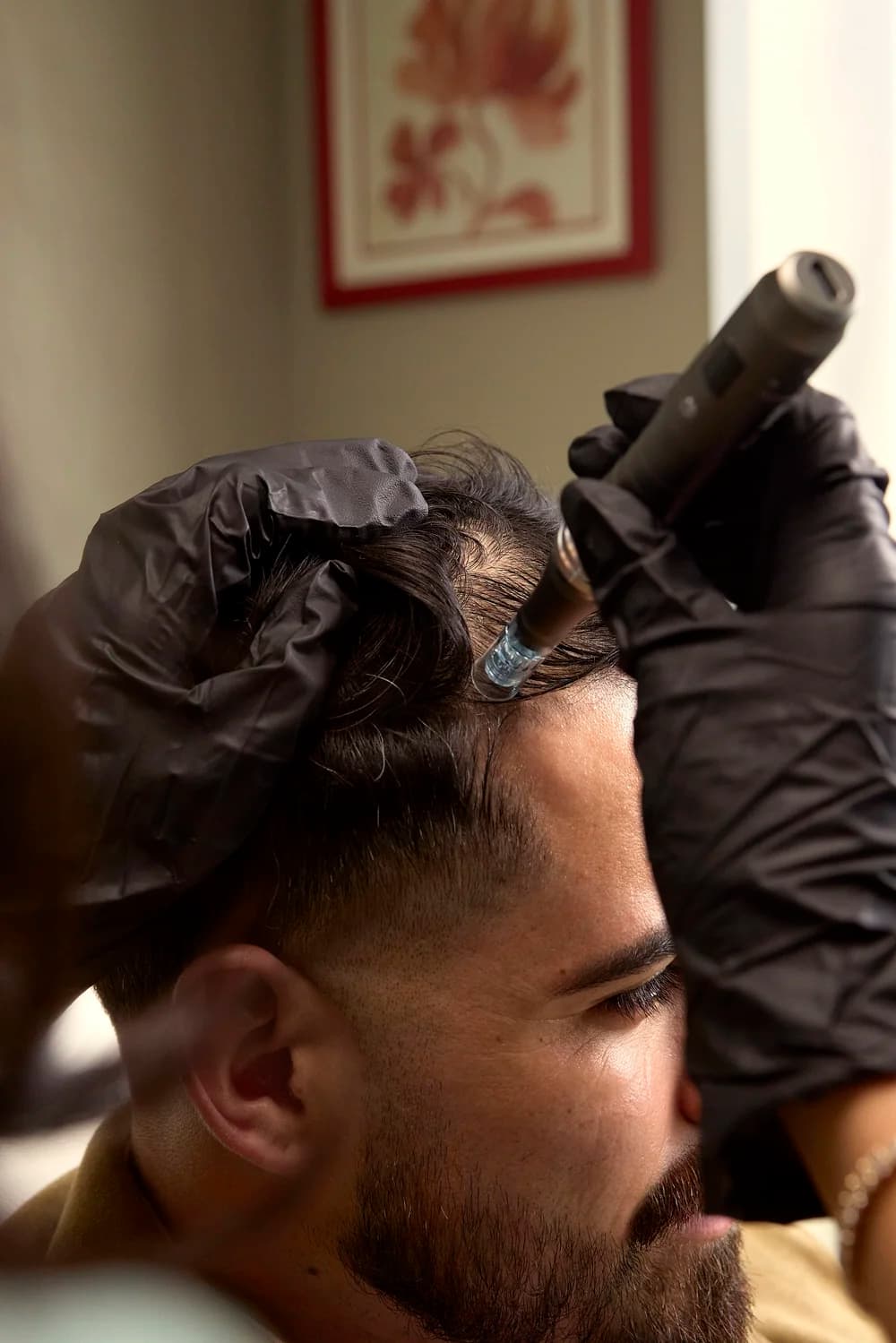 Buena Health hair restoration clinic